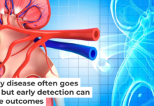 Testing for kidney function can help identify chronic kidney disease early enough to intervene. PIXOLOGICSTUDIO/Science Photo Library via Getty Images